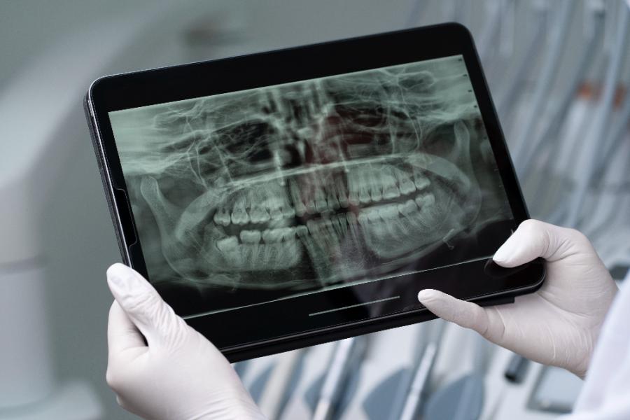 digital dental x-ray